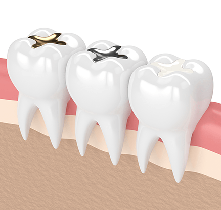 Treatment - Desford Dental Care